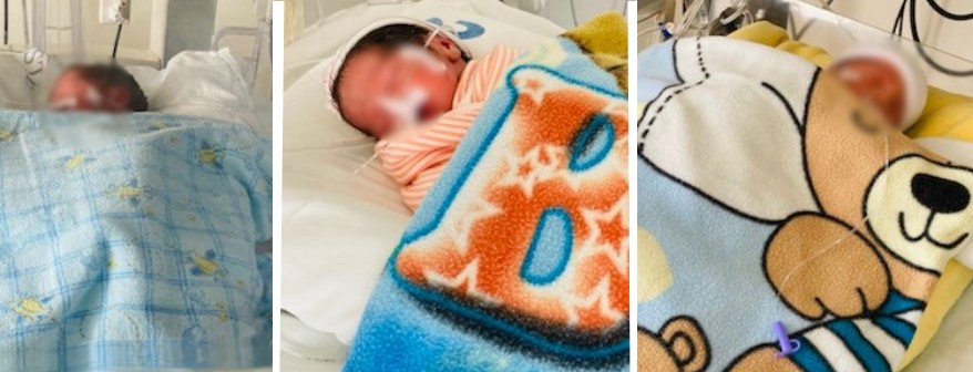 Nacen trillizos en el Hospital General Issste Zacatecas