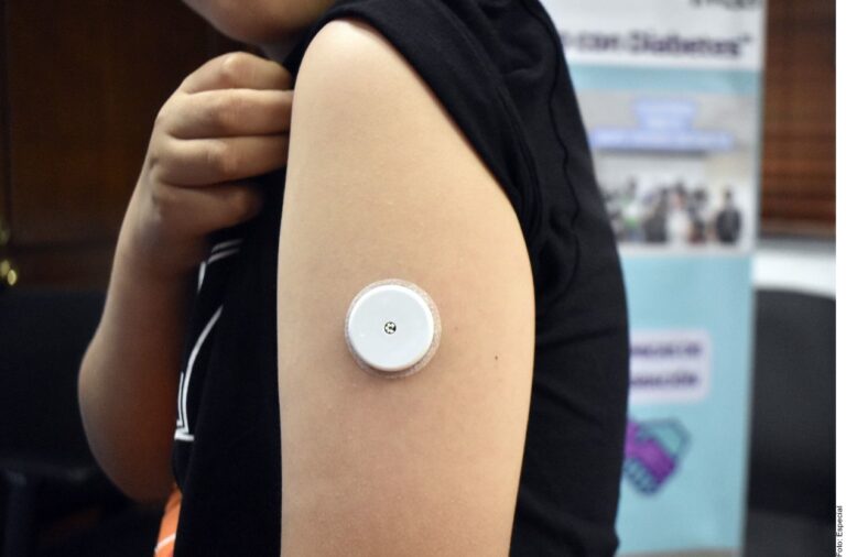 Coloca IMSS sensores a pacientes con diabetes