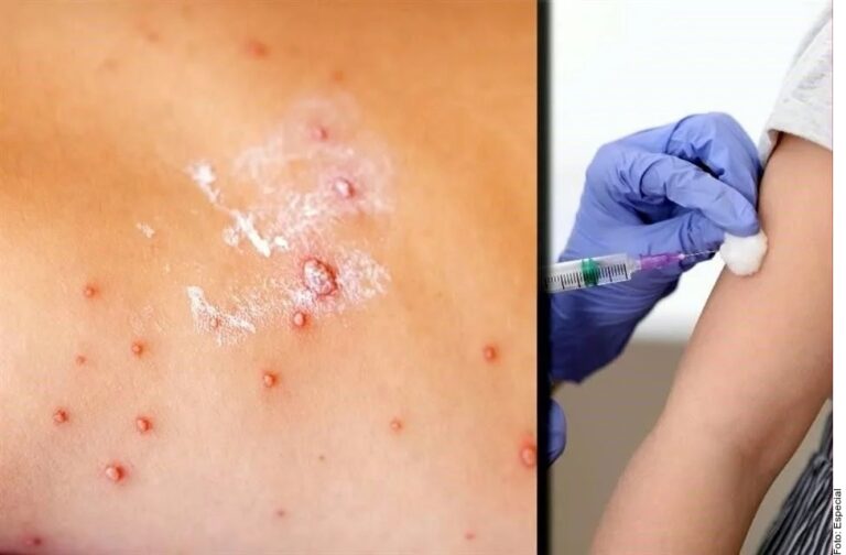 Atribuye Ssa a pandemia baja en vacunación contra sarampión