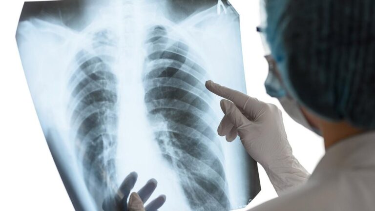 Ojocaliente y Concha del Oro, focos rojos en tuberculosis