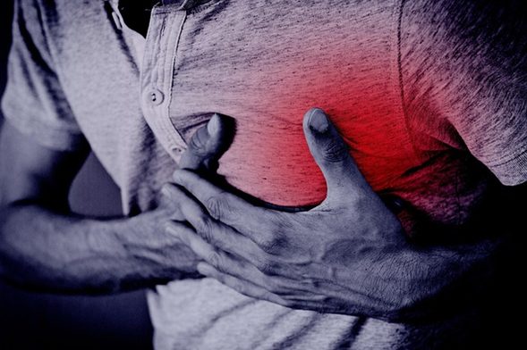 Código AMI: qué hacer en los primeros 90 minutos de un infarto