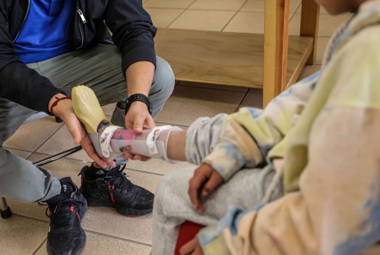 CREE diagnosticará a 70 pacientes para programa de prótesis